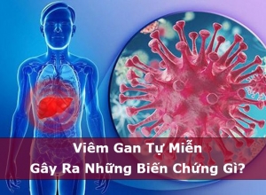 Viêm Gan Tự Miễn Gây Ra Những Biến Chứng Gì?